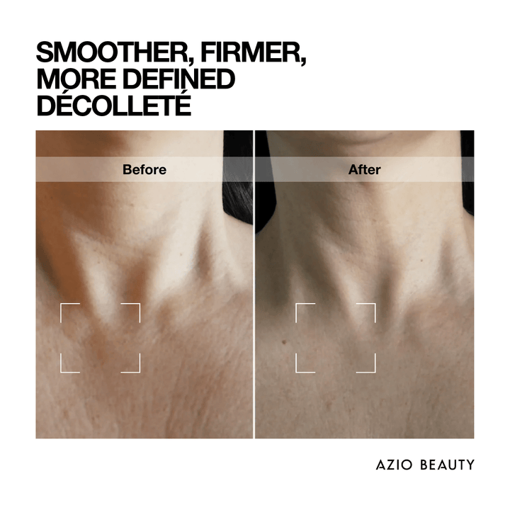 Lift Factor NECK & CHEST CREAM - Azio Beauty